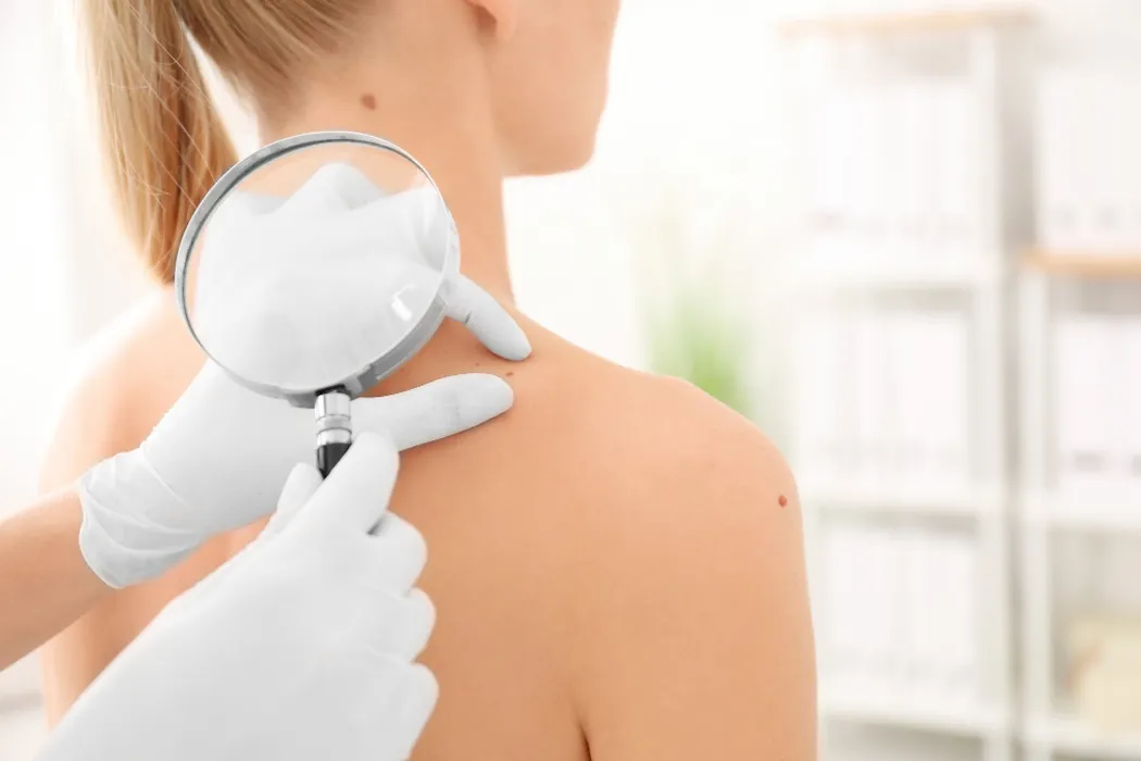 Dermatolog – specjalista, który zadba nie tylko o skórę