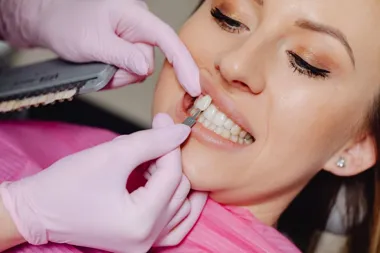 Dentysta dobiera kolor licówki do zębów uśmiechniętej pacjentki.